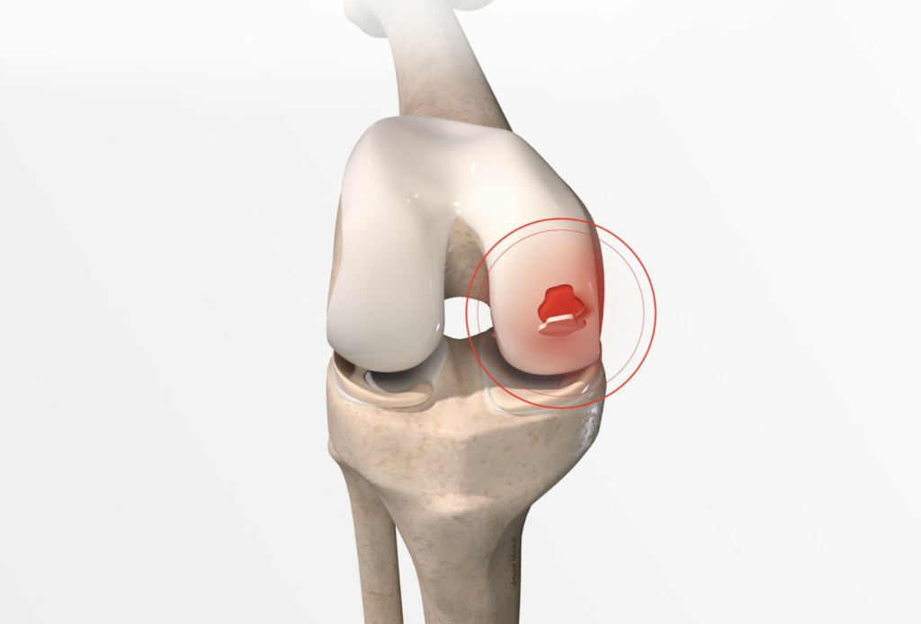 Best Orthopedic Surgeon in Malad