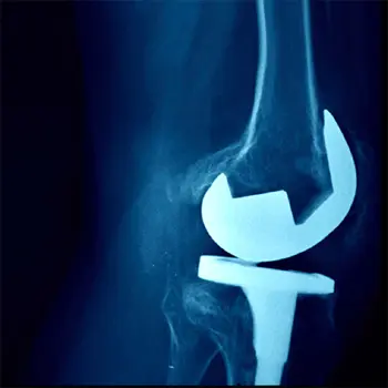 Orthopaedic Surgeon in Malad